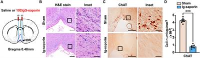 Fluoxetine and Ketamine Reverse the Depressive but Not Anxiety Behavior Induced by Lesion of Cholinergic Neurons in the Horizontal Limb of the Diagonal Band of Broca in Male Rat